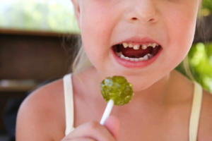 Child with cavities in baby teeth.