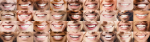 Collage of diverse smiles illustrating the natural variation in tooth shades among different patients.